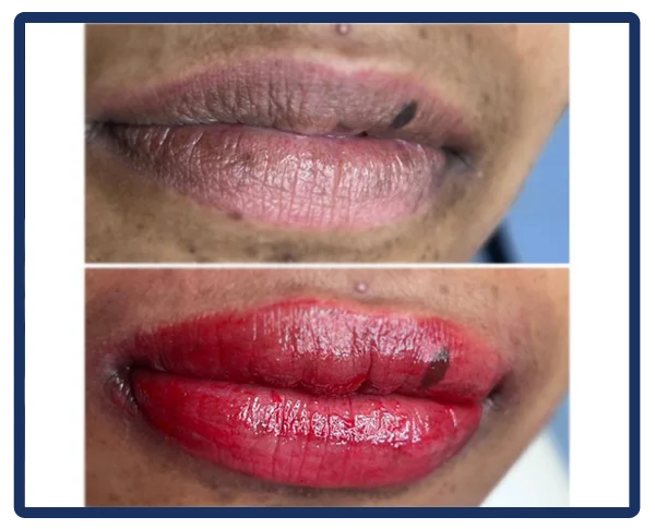 Aesthetic Treatments