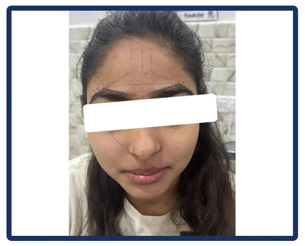 Aesthetic Treatments