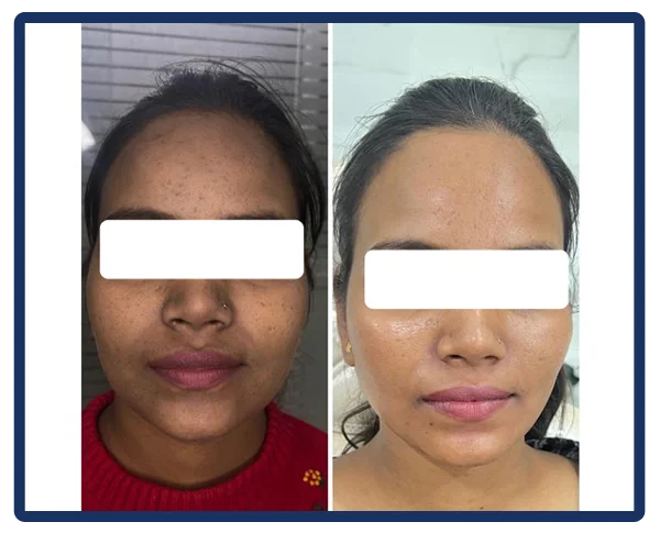 Aesthetic Treatments